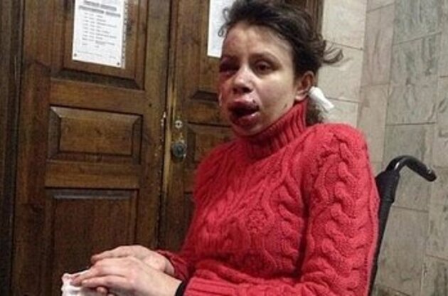 Милиция не исключает, что Татьяна Чорновол могла пострадать в ДТП