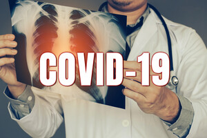В Киеве уже зафиксировали почти 33,7 тыс. случаев COVID-19, умерло – 674 человек 