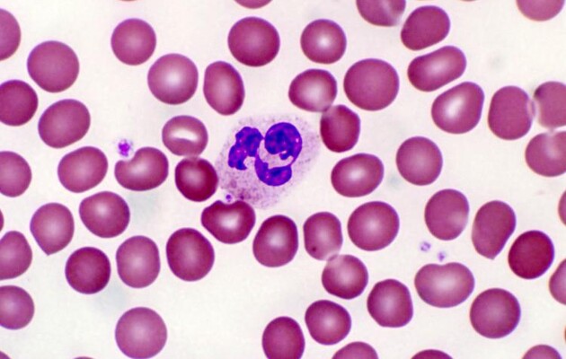 Відкрито нейтрофіли, які можуть допомогти в боротьбі з деменцією