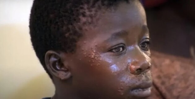 Хвороба проявилася після виходу в море