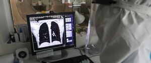 Симптомы рака легких и коронавируса очень схожи — онколог