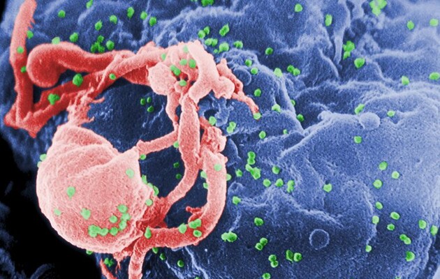 Вчені видалили схожий на ВІЛ вірус з генома приматів 