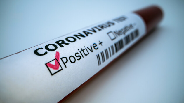 В январе Украина направит в лабораторию ВОЗ образцы для выявления нового штамма коронавируса – Ляшко