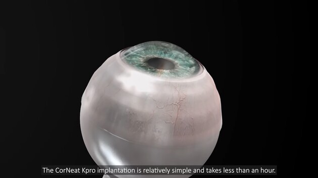 Имплант позволил мужчине увидеть людей и прочитать текст