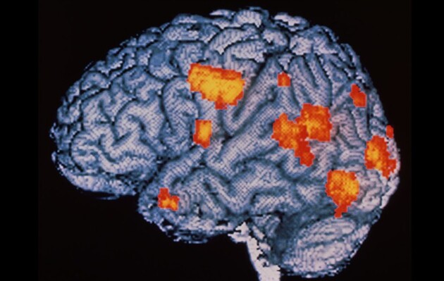 Шизофренія підвищує ризик смерті від коронавірусу