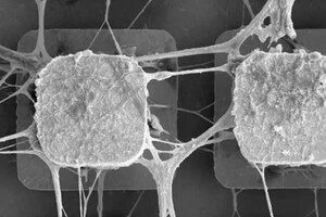 Ученые хотят использовать клетки мозга человека для создания микрочипов