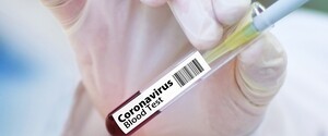 У трьох областях України COVID-19 поширюється швидше, ніж «дозволено»