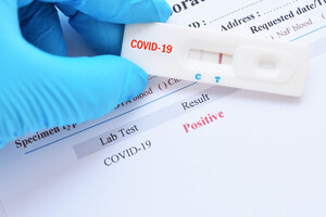 За сутки в Украине диагностировали более 2 тысяч новых случаев COVID-19 