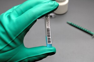 В Украине заработал сайт для записи на вакцинацию против COVID-19 