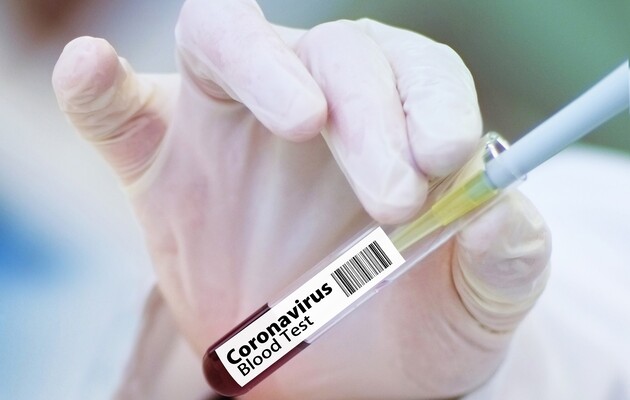 Условием для въезда в Украину станет отрицательный ПЦР-тест на коронавирус – Степанов 
