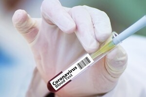 Умовою для в'їзду в Україну стане негативний ПЛР-тест на коронавірус – Степанов