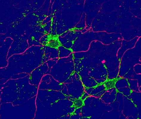 Вчені знайшли в мозку нові типи клітин 