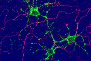 Ученые нашли в мозге новые типы клеток
