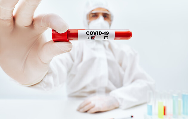 Заболеваемость коронавирусом в Украине снижается: менее 500 новых случаев за сутки 