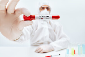 Заболеваемость коронавирусом в Украине снижается: менее 500 новых случаев за сутки 