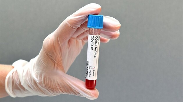 Штам коронавірусу «Дельта» виявили майже в ста країнах 