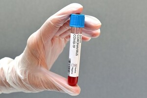 Штам коронавірусу «Дельта» виявили майже в ста країнах 