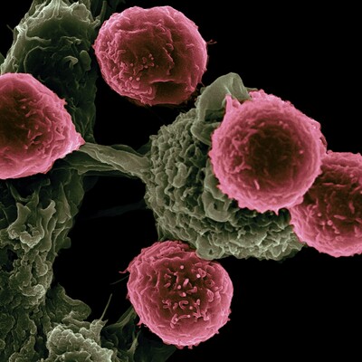 Клітини раку пожирають самі себе, щоб вижити 