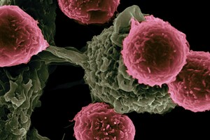 Раковые клетки пожирают сами себя, чтобы выжить