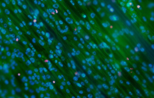 М'язову структуру м'яса змогли відтворити на основі клітини трави