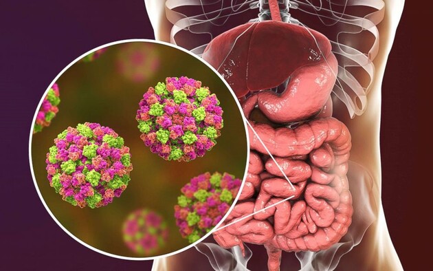 В Украине выявили пять массовых вспышек норовирусной инфекции