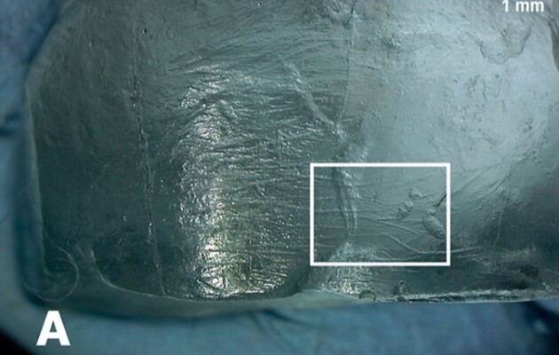 Сколы на зубах указали на использование зубочисток