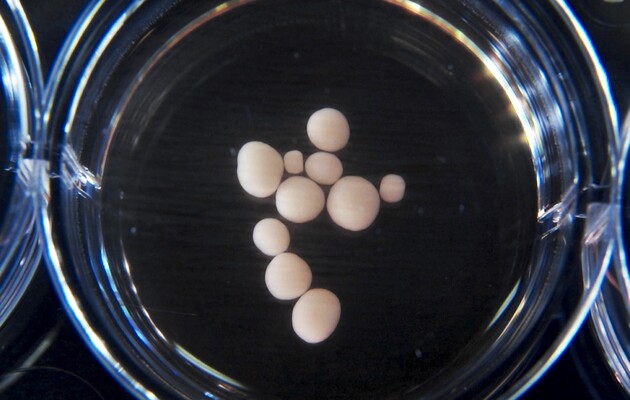 У органоїдів мозку з'явилися зародки очей