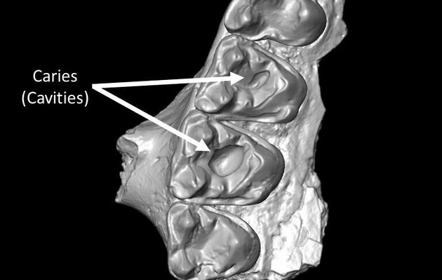 Часть верхней челюсти от Microsyops latidens с двумя кариозными полостями 