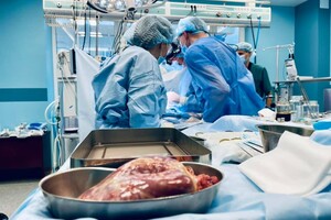 Вперше в Україні здійснили трансплантацію серця дитині 