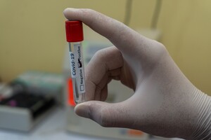 Україна вийшла на показники піку осінньої хвилі коронавірусу 