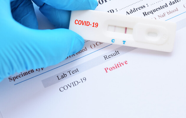Запаса тест-систем для выявления коронавируса хватит до конца первого квартала 2022 года – Ляшко 