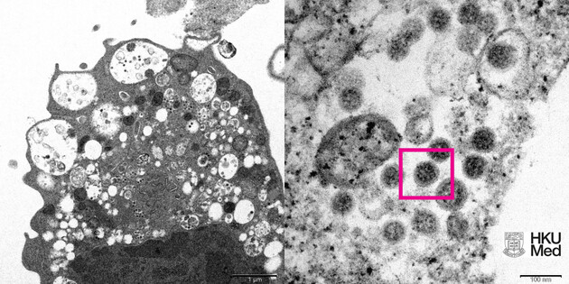 Ученые из Гонконга показали снимок штамма коронавируса «Омикрон»