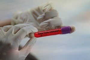 США та Європа не готові до боротьби з новим штамом коронавірусу «Омікрон» — The Economist 