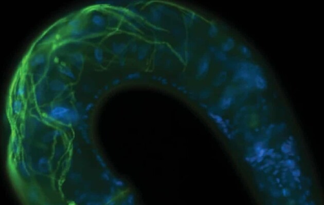 Бактерії витягуються в нитку і заражають кілька клітин відразу