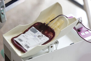 Запаси крові на випадок необхідності в країні є – директор мережі плазмацентрів “Біофарми”
