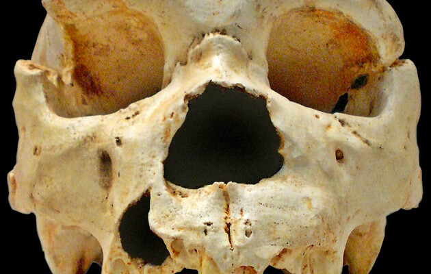 Авторство: José-Manuel Benito Álvarez, CC BY-SA 2.5, https://commons.wikimedia.org/w/index.php?curid=934791