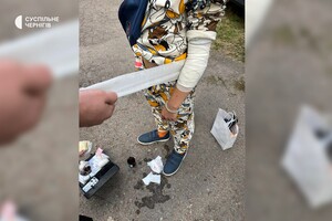 В Чернигове на выставке сдетонировал боеприпас: трое детей получили ранения