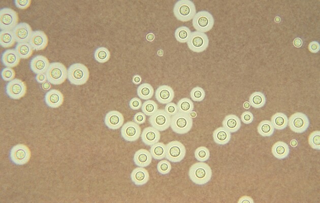 Небезпечні грибки можуть змінювати свою форму, щоб проникнути в мозок людини