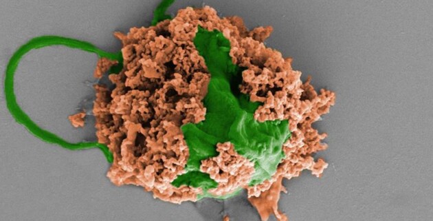 Микророботы позволяют вылечить пневмонию