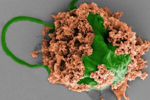 Крихітні роботи змогли очистити легені мишей від пневмонії