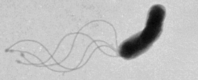 Ученые рассказали, как двигаются бактерии
