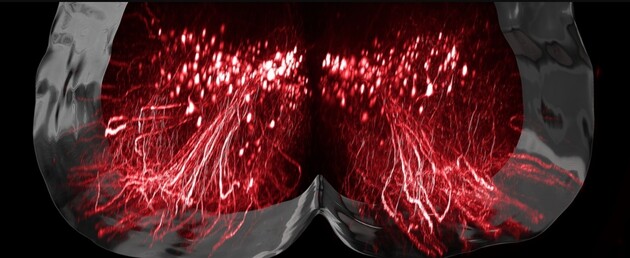 Стимуляція нейронів допомогла паралізованим людям ходити