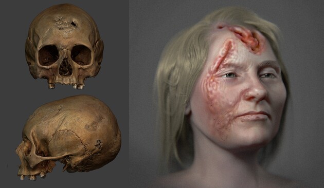 Ученые воссоздали внешность древней женщины со смертельным заболеванием