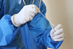 Зафиксирован первый в Украине случай заражения штаммом коронавируса 