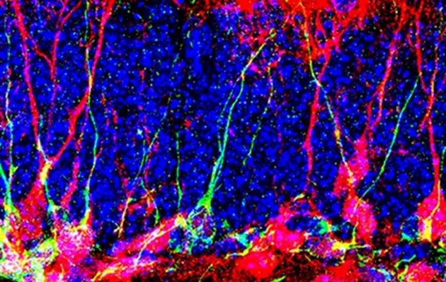 Ученые нашли способ выращивать новые нейроны в мозге