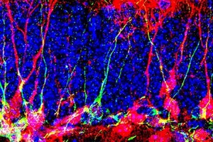 Вчені знайшли спосіб вирощувати нові нейрони в мозку
