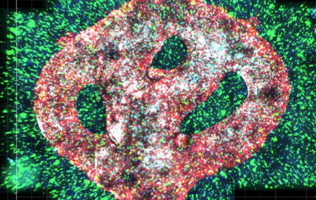 Новий «Троянський кінь»: вчені проникли всередину ракових клітин та змусили їх вбивати себе