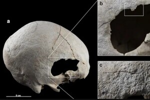 Женщина медного века пережила две трепанации черепа еще 4500 лет назад