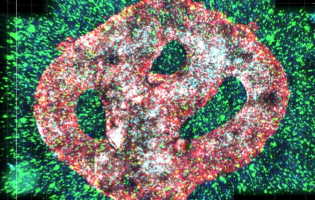 Вченим вдалося знайти новий метод лікування раку