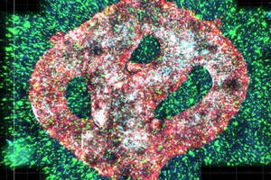 Ученые смогли убить 99% раковых клеток с помощью вибрирующих молекул